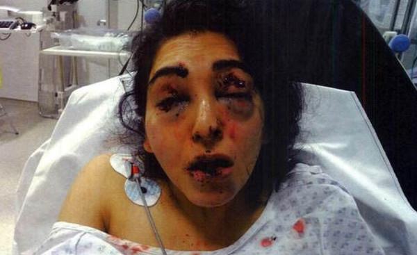 Jageer photo when she was admitted to hospital after attack on her