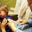 measles-670
