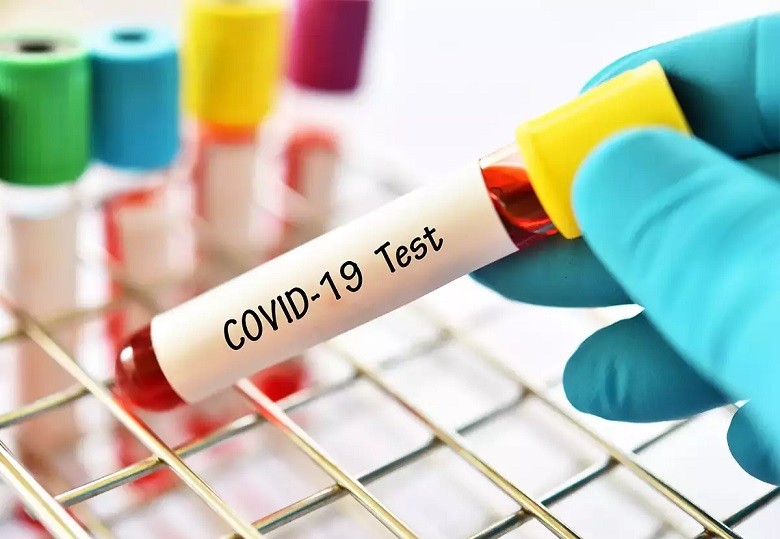 COVID-19 tests - There are 102 testing labs functional in Pakistan wherein 24,620 tests were conducted in the last 24 hours to diagnose the Coronavirus (COVID-19), the highest figure to date. As part of daily routine, the National Command and Operation Centre (NCOC) on Tuesday undertook an in-depth review of the National Anti COVID-19 short term action plan for June/July to meet additional requirements. The forum discussed in detail the incentive package for front line healthcare workers who are fighting COVID-19 as front line heroes To ensure compliance to Standard Operating Procedures (SOPs) for containment of COVID-19, the authorities throughout Pakistan have taken widespread action against markets, industries, and transport. Dedicated teams of all provinces have ensured that those not adhering to health instructions/ guidelines are sensitized as SOPs compliance. Latest figures received from provinces during the last 24 hours about the actions taken for SOPs compliance included: Balochistan: In Balochistan, 691 violations were observed due to which 250 shops and 92 transports/vehicles were temporarily closed/fined and cautioned. Punjab: In Punjab, 769 shops, 8 industries, 776 transports were closed/fined/cautioned all across the province on 2,865 SOP violations. Sindh: Strict actions were taken against SOP violators including Shops and transports all across Sindh. Khyber Pakhtunkhwa: 7,351 SOP violations were observed in Khyber Pakhtunkhwa in which 302 shops and 221 transports were cautioned and sealed while 1933 individuals were fined. Gilgit-Baltistan: In Gilgit-Baltistan, 67 shops and 70 transport were fined/sealed on 270 violations of health guidelines/instructions. Islamabad Capital Territory (ICT): 101 SOPs violations were marked in the ICT in which 13 hotels, 24 shops, 2 industries, and 36 transports were fined/sealed. Azad Jammu and Kashmir (AJK): 422 SOPs violations were observed in AJK during which 112 shops/and 85 transports were fined/sealed.