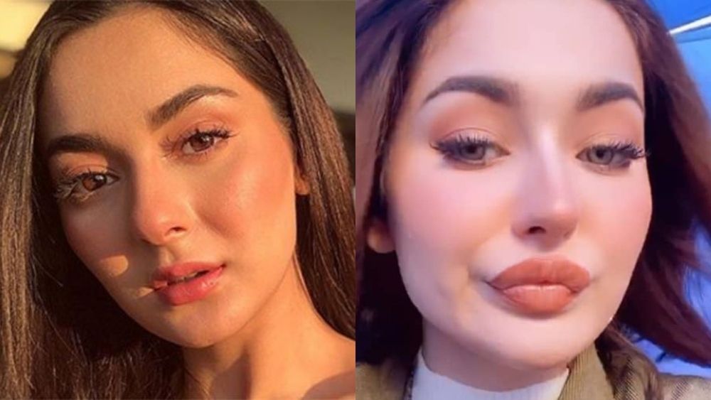 Hania Amir has been the center of attention these days for many reasons. However, the most significant reason is that rumors were there about her having lip filler treatment. As she stays all the time active on social media and specifically on Instagram, so the fans noticed her lips like filled up. However, there was no clarification from Hania's side in this regard and fans kept on criticizing her. So, Hania Amir has now finally revealed the inside story about her new big lips look, and here we have got the details! Did Hania Amir Actually Get Lip Filler Treatment? We know that recently Hania had to go through fierce criticism regarding her spoiled looks as fans thought of her having lip fillers. All the fans gathered in the comments section of the pictures she posted and started bashing her. None of them even bothered to wait to know what is the actual story behind this look. However, the fact is that Hania also didn't have any idea about why she is having her lips swollen while making a video. To put it more appropriately into words, she knew about the filter she was using to capture pictures and videos. However, Hania wasn't aware of the settings related to the filter.   So, here we have got a video in which Hania has revealed the inside story with a demonstration. Watch it now! Well... it was all about the adjustment of filter settings and Hania calls herself the 'dumbest' person as she didn't know about it. She has clarified that it was nothing about the lip fillers but simply the filter setting and now Hania knows it well.  This revelation of the inside story settles down the hype created following bashing session by fans and Hania's lip surgery controversies.  So, what are your views on the video posted by Hania Amir to clear her stance? Share your views with us to this write-up more of an interesting thing!