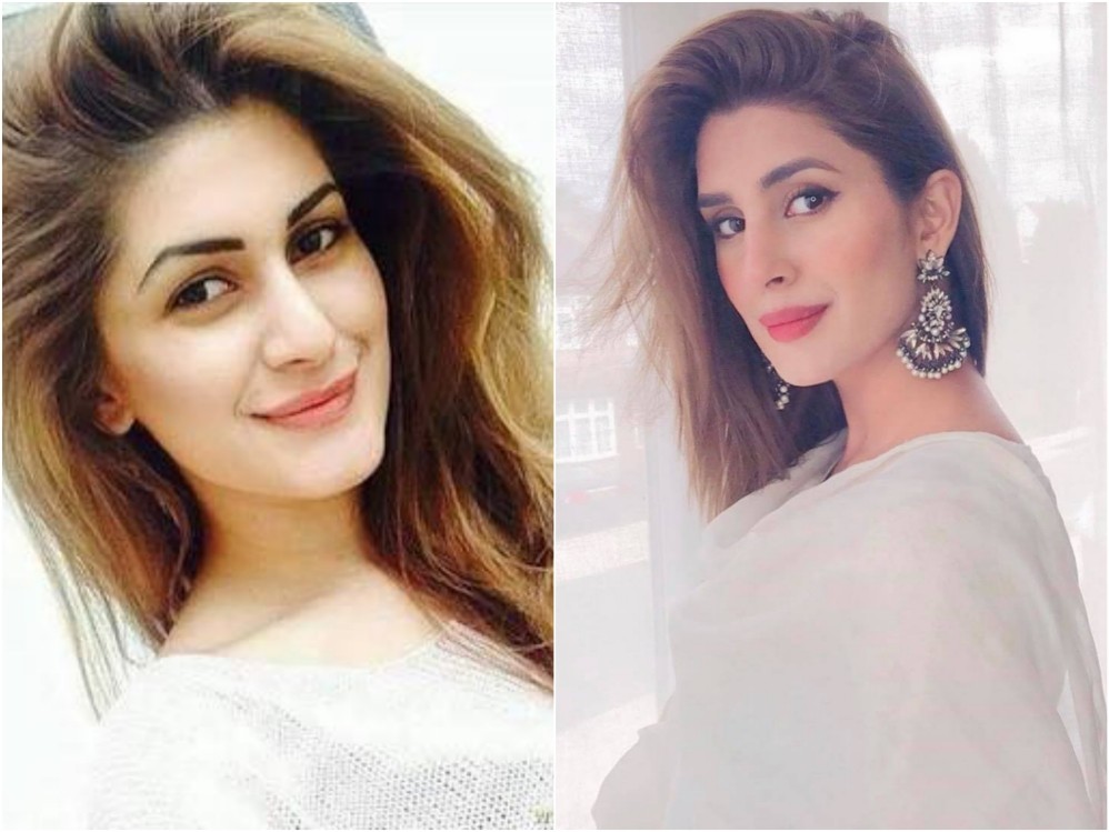 10 Pakistani Celebrities Who Have Got Lip Fillers Done - Pictures Inside!