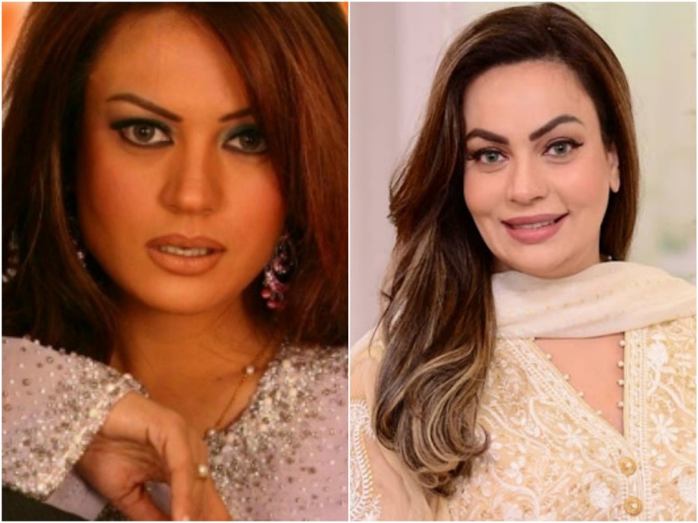 10 Pakistani Celebrities Who Have Got Lip Fillers Done - Pictures Inside!