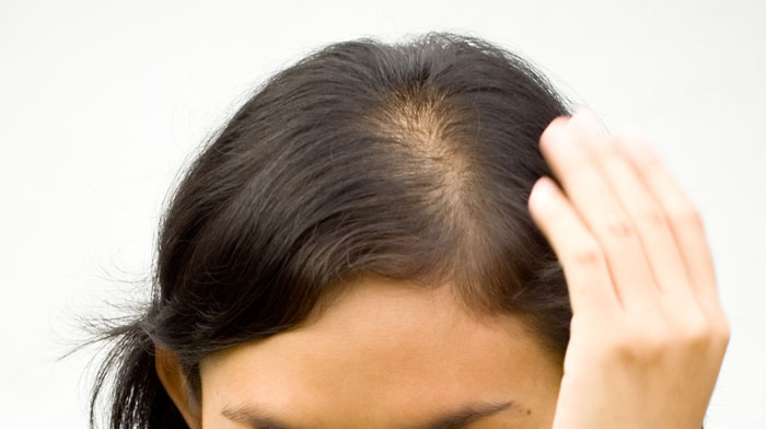 Here Is You Can Stop Suffering From Excessive Hair Loss!
