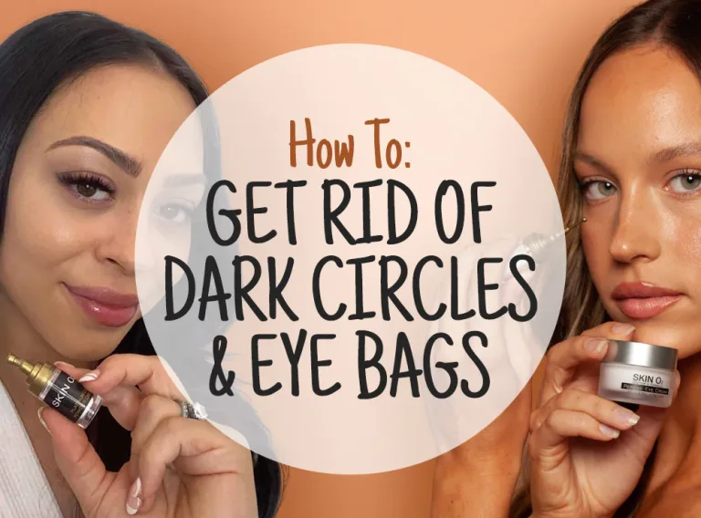 How to get rid of dark circles