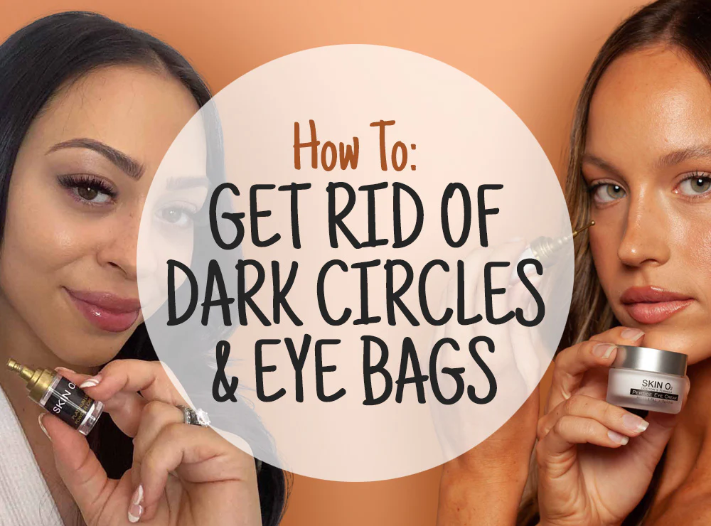 How to get rid of dark circles