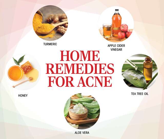 Acne Guide 101: Types, Causes, Treatment, Home Remedies, Skin Care